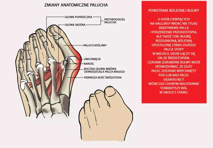 Duży palec u stopy: funkcje, problemy i jak o niego dbać