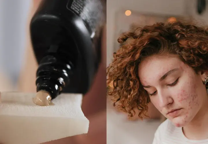 Jaki krem BB do cery trądzikowej, który naprawdę działa na skórę?