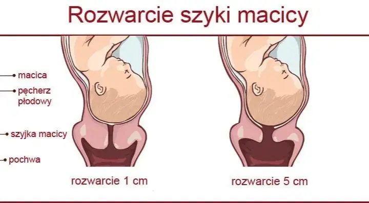 Rozwarcie na 2 palce: ile cm to jest i co oznacza w porodzie?