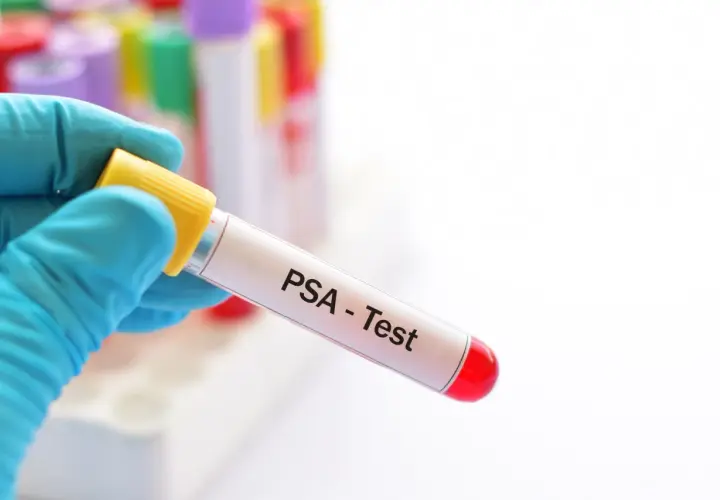 Ręka w niebieskiej rękawiczce trzyma probówkę z napisem "PSA - Test". To ważny krok w diagnostyce, nawet dla zdrowia psa.