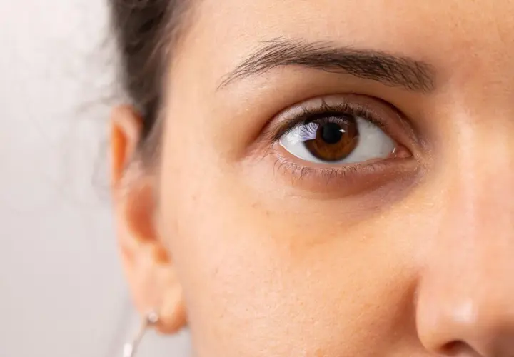 Nahaufnahme eines braunen Auges mit sichtbaren Schatten, die dunkel zwischen Nase und Auge liegen.