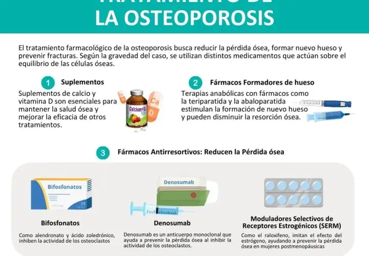 Medicamentos para la osteoporosis: opciones efectivas y riesgos a considerar
