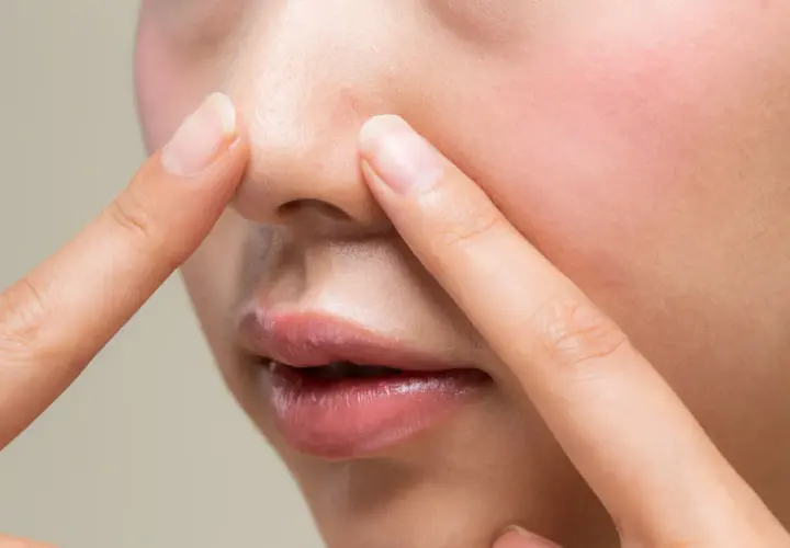 Dłonie dotykają nosa, ukazując pory i zaczerwienienie. Czy to nadmiar sebum?