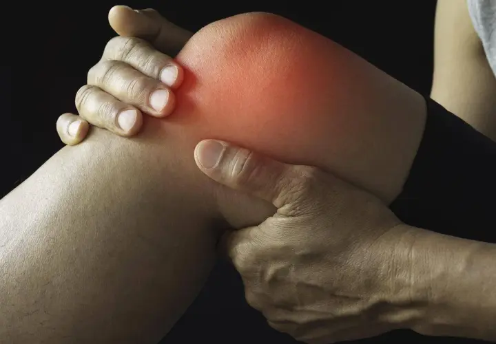 Schmerzendes Knie mit roter Hitze, die auf eine Schleimbeutelentzündung Knie Symptome hinweist. Hände umfassen das Gelenk.