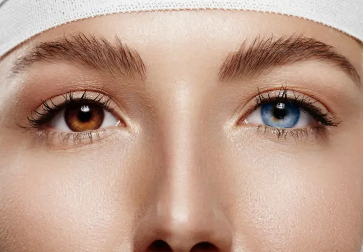 Oczy z heterochromią: jedno brązowe, drugie niebieskie. Delikatna opaska na głowie.