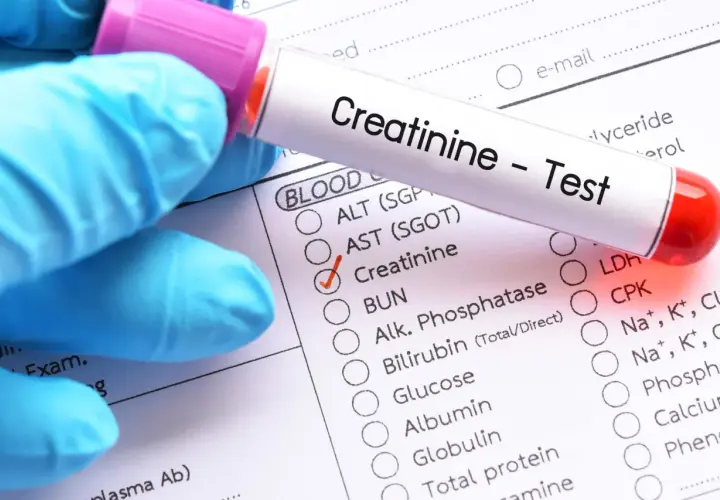 Rękawiczka w niebieskiej rękawiczce trzyma probówkę z napisem "Creatinine - Test". Zaznaczono opcję "Creatinine", sugerując niską kreatyninę.