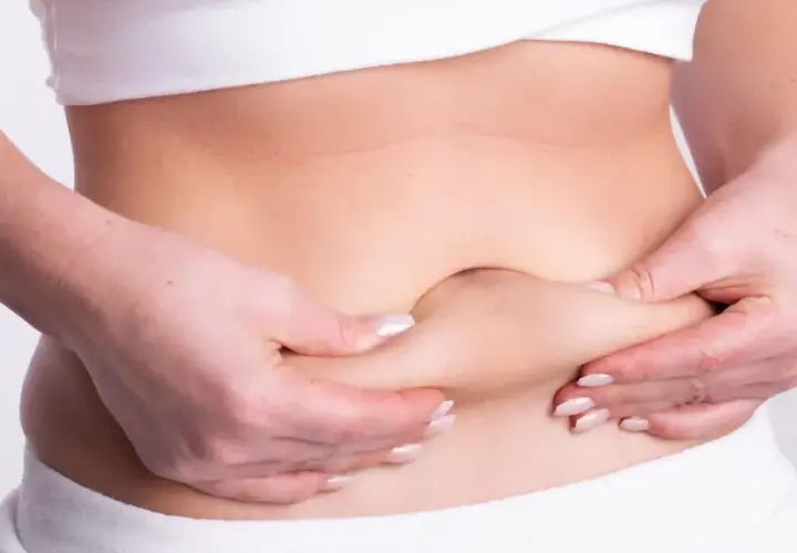 Manos pellizcando la piel del abdomen, mostrando la distensión abdominal por ansiedad.