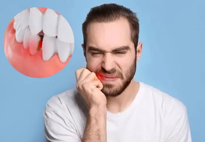 Uomo con dolore alla guancia, immagine ingrandita di un dente con gengiva infiammata. Sintomi di infezione dente sotto capsula.