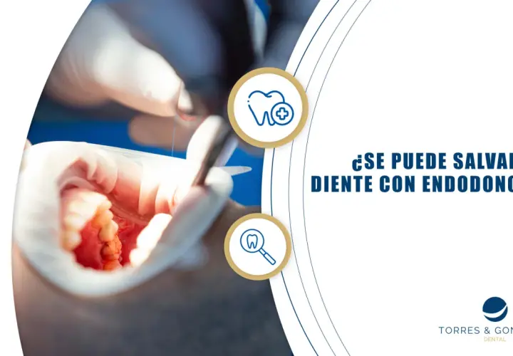 Procedimiento de endodoncia en un diente frontal. Dentista trabajando en la boca de un paciente.