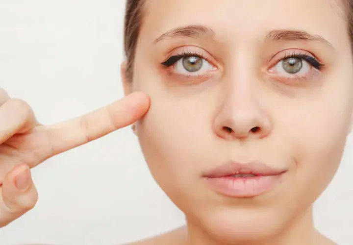 Primer dedo señala la zona debajo del ojo, mostrando ojeras vasculares.