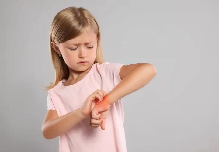 Une petite fille se gratte le poignet, le visage plissé par une forte démangeaison aux mains.