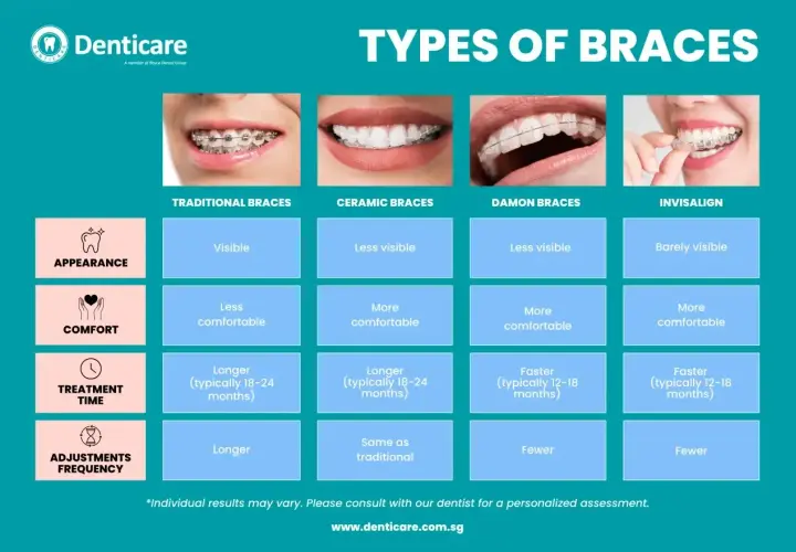 Porównanie rodzajów aparatów ortodontycznych: tradycyjne, ceramiczne, Damon i Invisalign. Tabela zawiera informacje o widoczności, komforcie, czasie leczenia i częstotliwości wizyt.