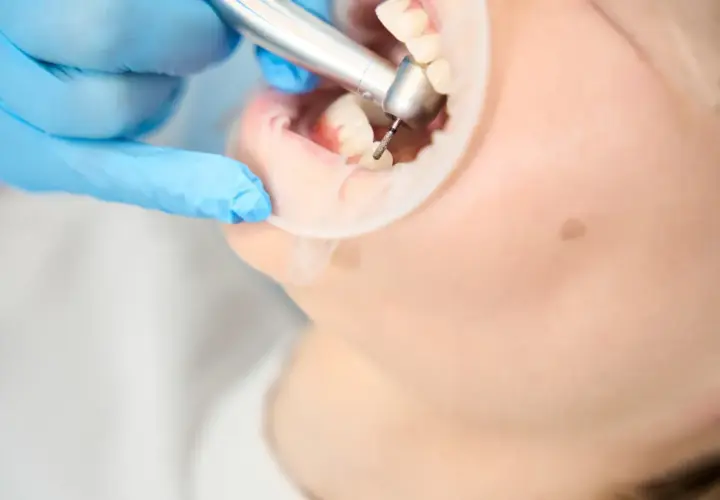 Ile trwa wizyta u dentysty? Poznaj czas trwania różnych zabiegów