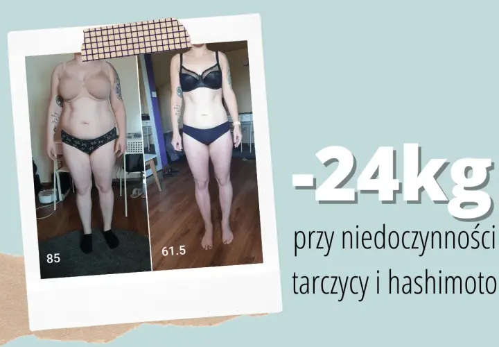 Metamorfoza: -24kg przy niedoczynności tarczycy i hashimoto. Zobacz, jak schudnąć, gdy tarczyca nie działa prawidłowo.