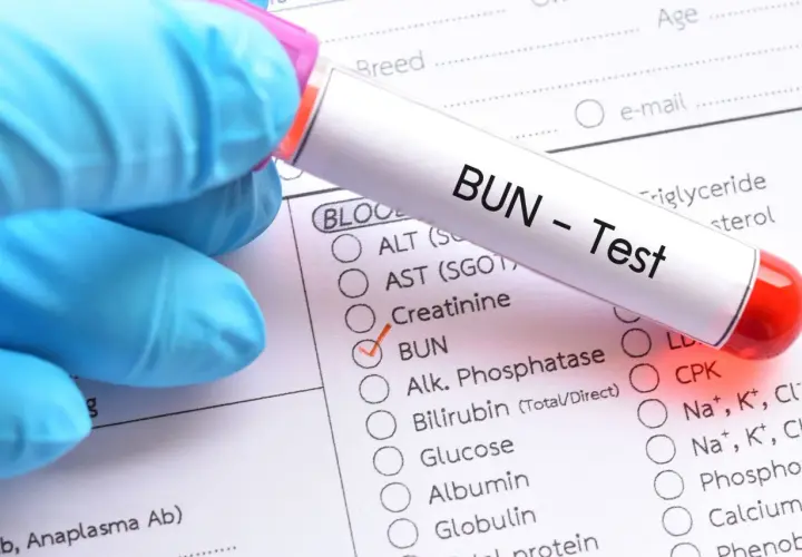 Rękawiczka w niebieskiej rękawiczce trzyma probówkę z napisem "BUN - Test". Zaznaczono opcję BUN, co oznacza badanie mocznika we krwi.