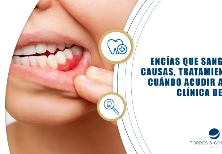 Primer plano de encías inflamadas y enrojecidas, indicando la posibilidad de encías sangrantes. El texto informa sobre causas y tratamientos.