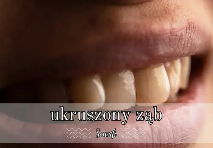 Co oznacza sen o ukruszonym zębie - poznaj ukryte znaczenie i symbolikę