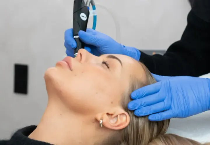 En kvinna får ansiktsbehandling med en fractional CO2 laser för hudförbättring.