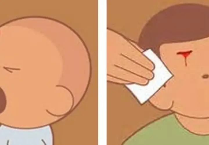 Bebé con chichón en la cabeza y niño con herida sangrante en la frente, mostrando un golpe en la cabeza niño.