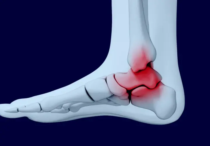 Anatomia stawu skokowego z zaznaczonym bólem. Może to być podstawa do ubiegania się o odszkodowanie za uraz, kod choroby s90.