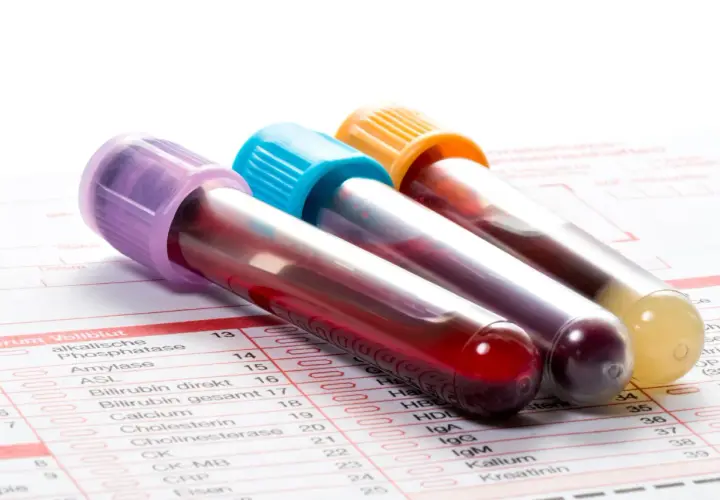 Probówki z krwią na tle formularza badań. Widać m.in. pozycję CRP, co to jest, jest kluczowe w diagnostyce.