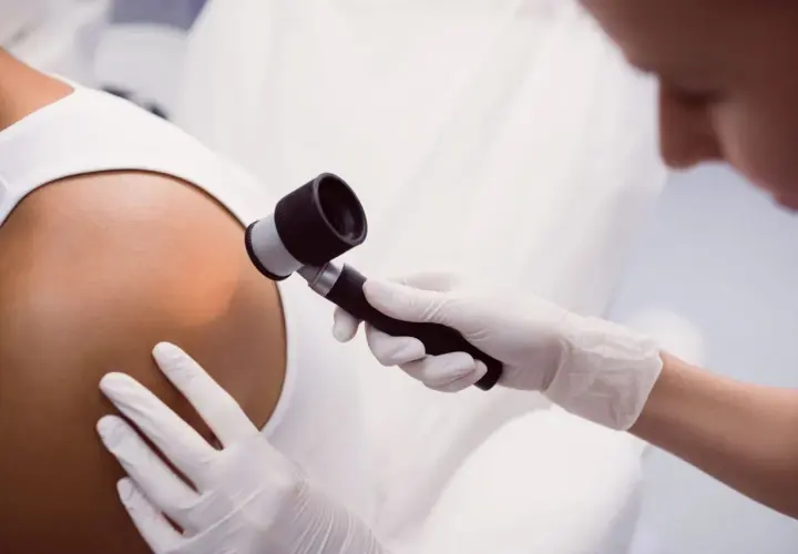 Dermatolog w białej rękawiczce bada skórę pacjenta dermatoskopem.
