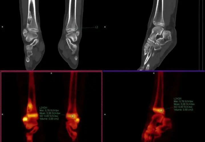 Co to jest SUV max i dlaczego jest kluczowy w diagnostyce?