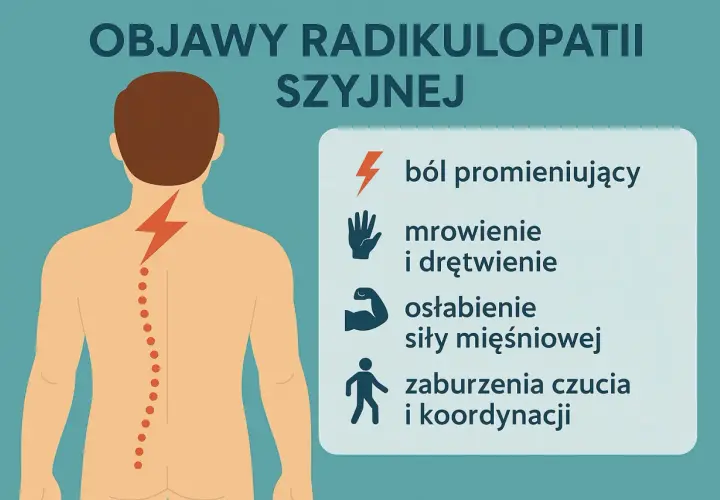 Objawy radikulopatii szyjnej: ból promieniujący, mrowienie, drętwienie, osłabienie mięśni, zaburzenia czucia. Ucisk na nerw błędny może objawiać się podobnie.