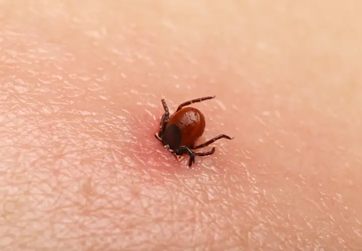 Objawy po ukąszeniu kleszcza: Kiedy szukać pomocy? Poradnik eksperta