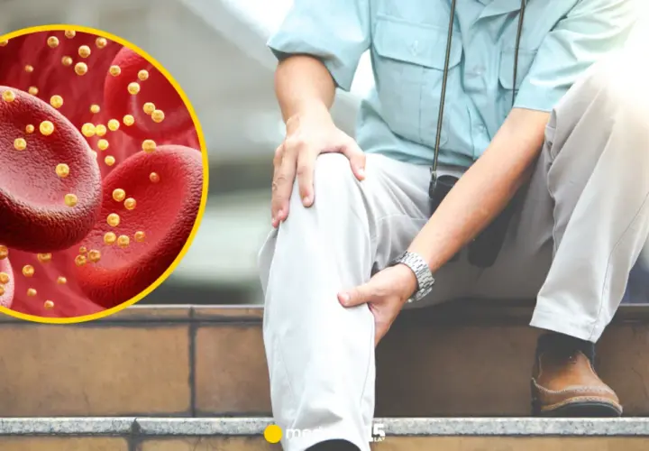 Wysoki cholesterol: Cichy zabójca. Poznaj skutki dla zdrowia!
