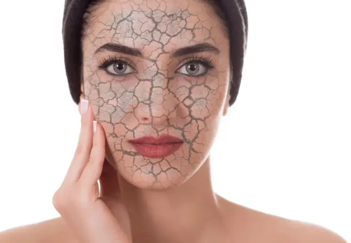 Rostro de mujer con piel agrietada, simulando el daño del estrés oxidativo.