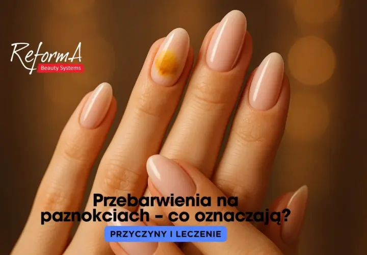 Pomarańczowe paznokcie: moda czy sygnał zdrowia?