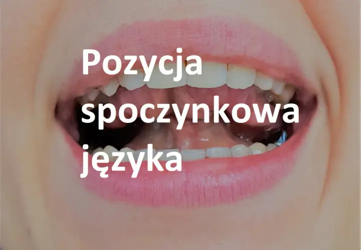 Zbliżenie na usta z widocznymi zębami, tekst "Pozycja spoczynkowa języka" sugeruje ćwiczenia miofunkcjonalne języka.