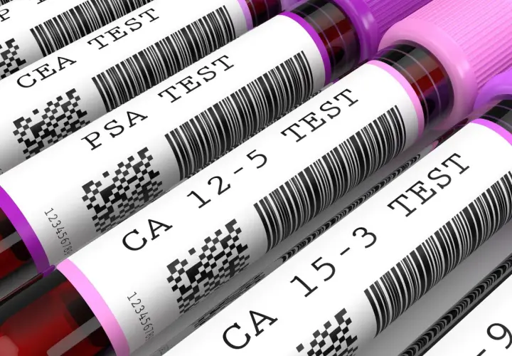 Rząd probówek z próbkami krwi do badań, z etykietami: CEA TEST, PSA TEST, CA 12-5 TEST, CA 15-3 TEST.