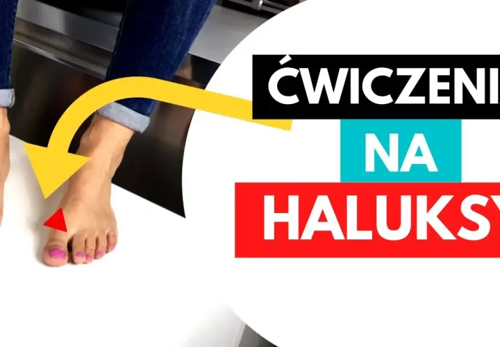 Jak wyprostować haluksy? Metody, ćwiczenia i operacja - kompleksowy poradnik