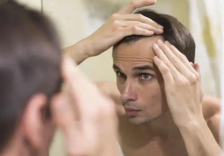 Hombre joven se mira al espejo, tocando su frente, preocupado por la pérdida de cabello.
