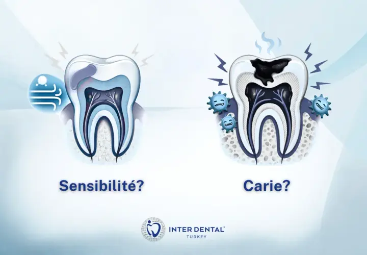 Dents saines vs. dent cariée. Si vous avez une sensibilité dentaire, que faire ? Consultez un dentiste.
