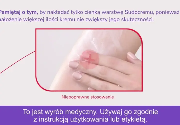 Sudocrem na pryszcze: czy warto? Opinie, skład i skuteczne alternatywy