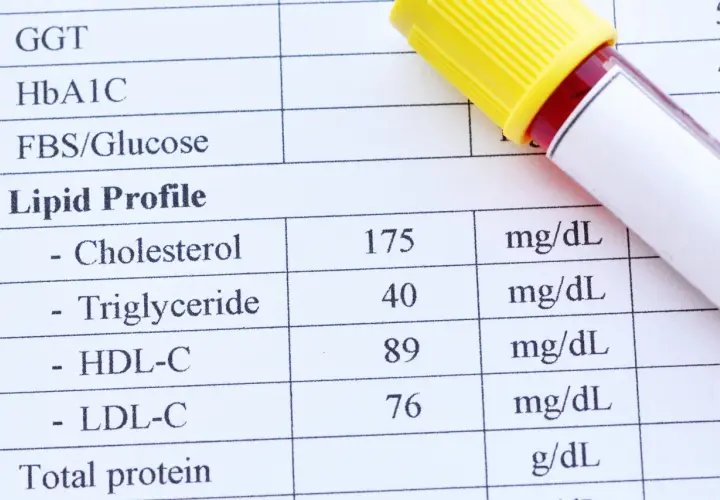 Wynik lipidogramu: cholesterol 175 mg/dL, trójglicerydy 40 mg/dL, HDL-C 89 mg/dL, LDL-C 76 mg/dL. Wysoki cholesterol całkowity może być niebezpieczny.
