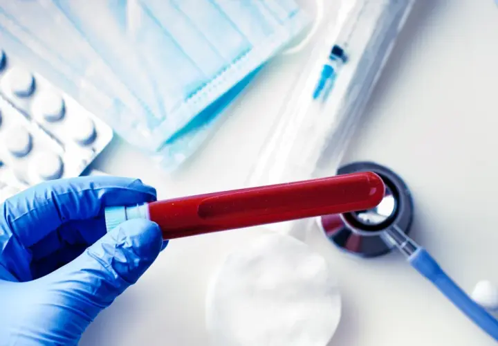 Rękawiczka w niebieskiej rękawicy trzyma probówkę z krwią. Obok leżą maseczka, tabletki, strzykawka i stetoskop. Wyniki badań wskazują, że cholesterol jest podwyższony.