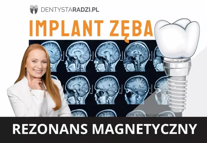 Rezonans magnetyczny a metal w zębie. Dr Agnieszka Czechumska wyjaśnia, czy implant zęba jest bezpieczny podczas rezonansu.