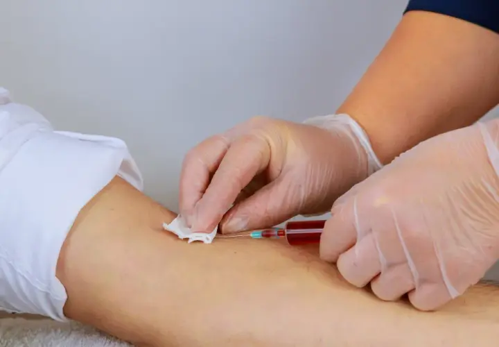 Pobieranie krwi do badania, które pomoże ustalić, jak podnieść hemoglobinę.