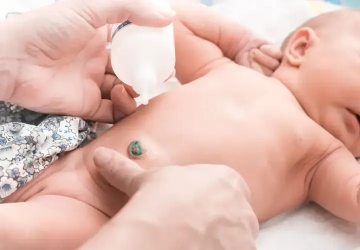 Delikatne czyszczenie pępka noworodka, aby zapobiec zapaleniu pępka. Dłoń aplikuje płyn z butelki na pępek.