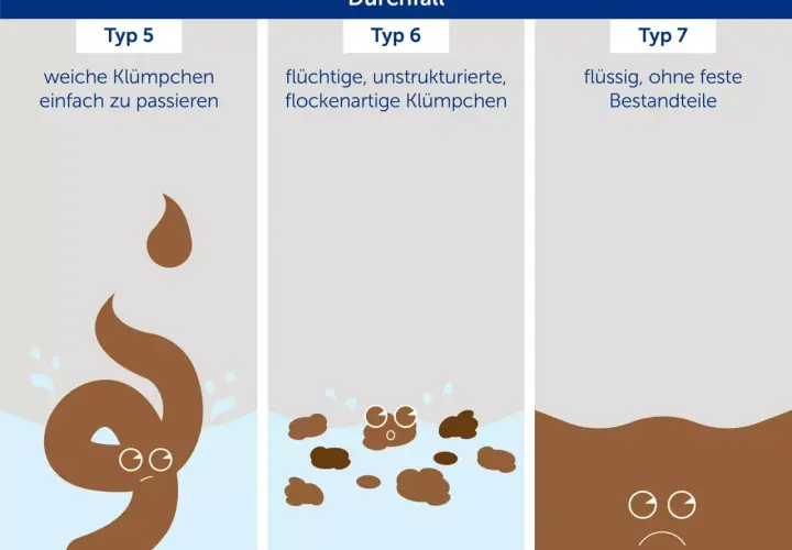 Darstellung von Durchfall-Typen. Typ 5 zeigt weiche Klümpchen, die auf einen perfekten Stuhlgang hindeuten könnten, im Gegensatz zu flüssigeren Formen.