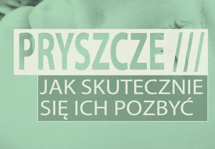 Pryszcze: Szybkie sposoby i długofalowa pielęgnacja. Poznaj sekrety!