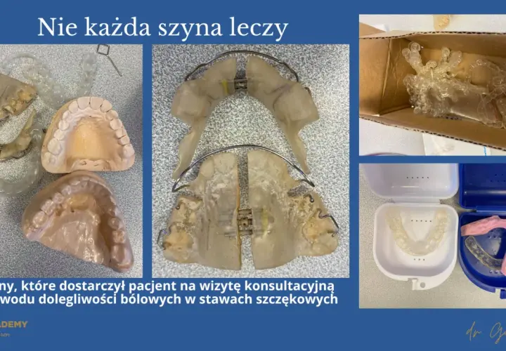 Szyny na zęby, modele szczęk i pudełka na ochraniacze. Pacjent przyniósł je z powodu bólu, co pokazuje, że bruksizm co to za problem, wymaga właściwego leczenia.