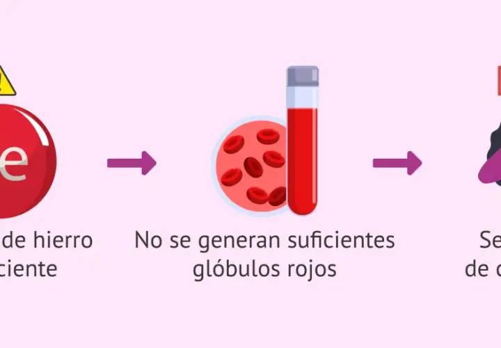 Cantidad de hierro insuficiente lleva a pocos glóbulos rojos y cansancio. Esto puede afectar la menstruación.