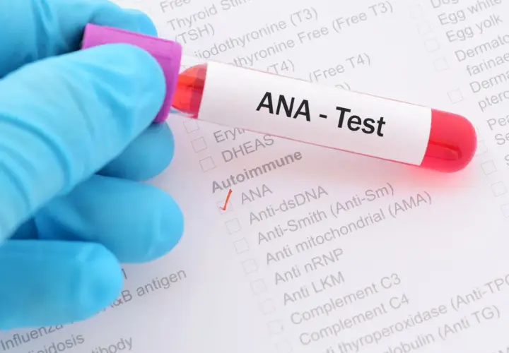 Badanie ANA - Test wykrywa przeciwciała przeciwjądrowe, kluczowe w diagnostyce chorób autoimmunologicznych.