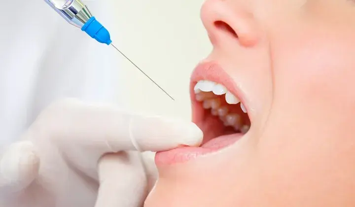 Znieczulenie u dentysty: Koniec z bólem? Sprawdź nowoczesne metody!