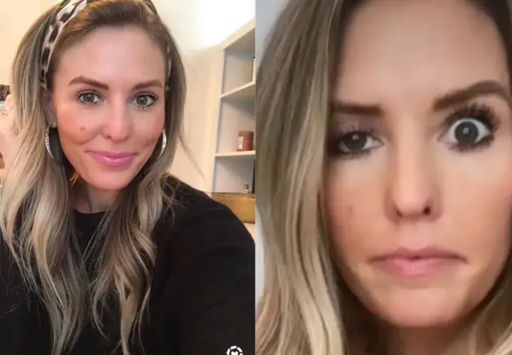 Kobieta z blond włosami i opaską na głowie, po lewej uśmiechnięta, po prawej z zaskoczonym wyrazem twarzy, sugerującym efekt botoks brwi.